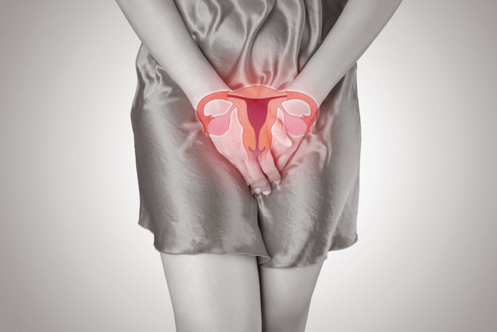 Síntomas de endometriosis: Cuando no es la regla lo que duele