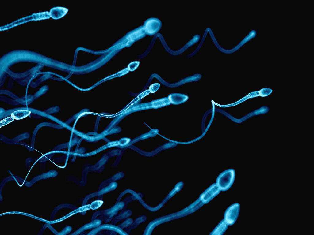 Astenozoospermia y otras “enfermedades” del semen y los espermatozoides