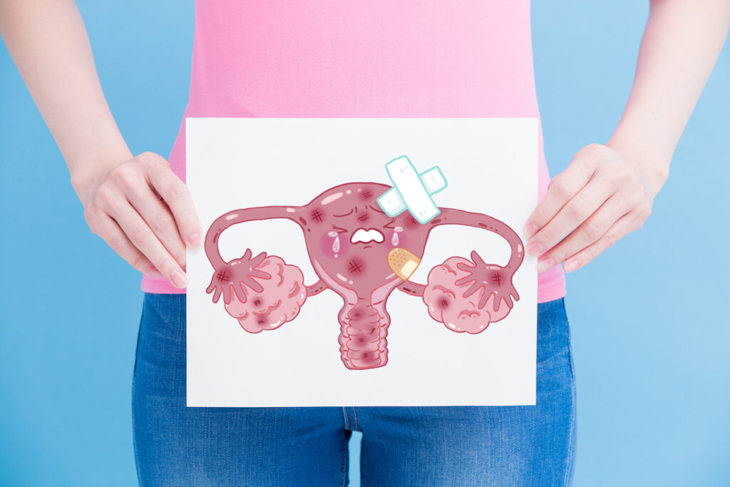 ¿Es posible el embarazo con miomas uterinos?