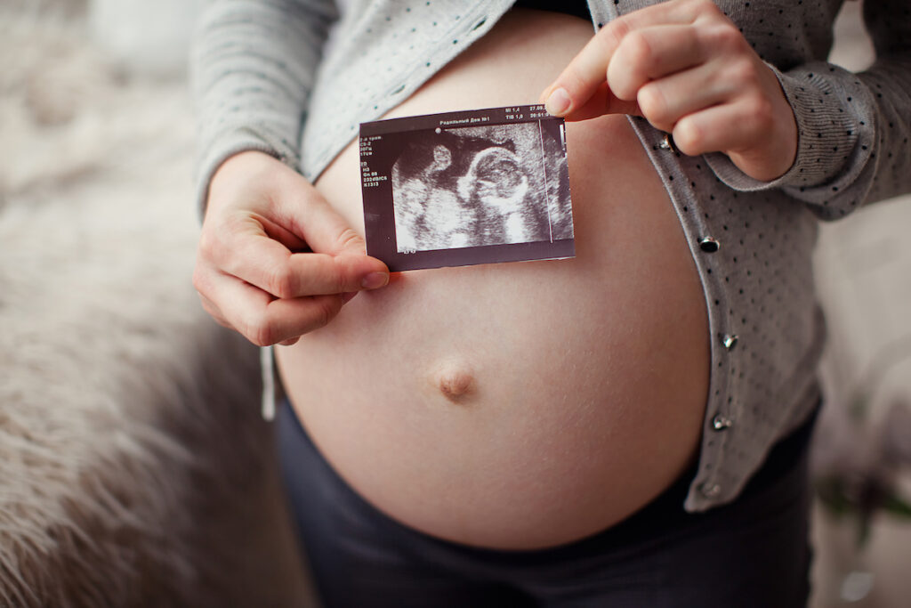Miomas uterinos y embarazo