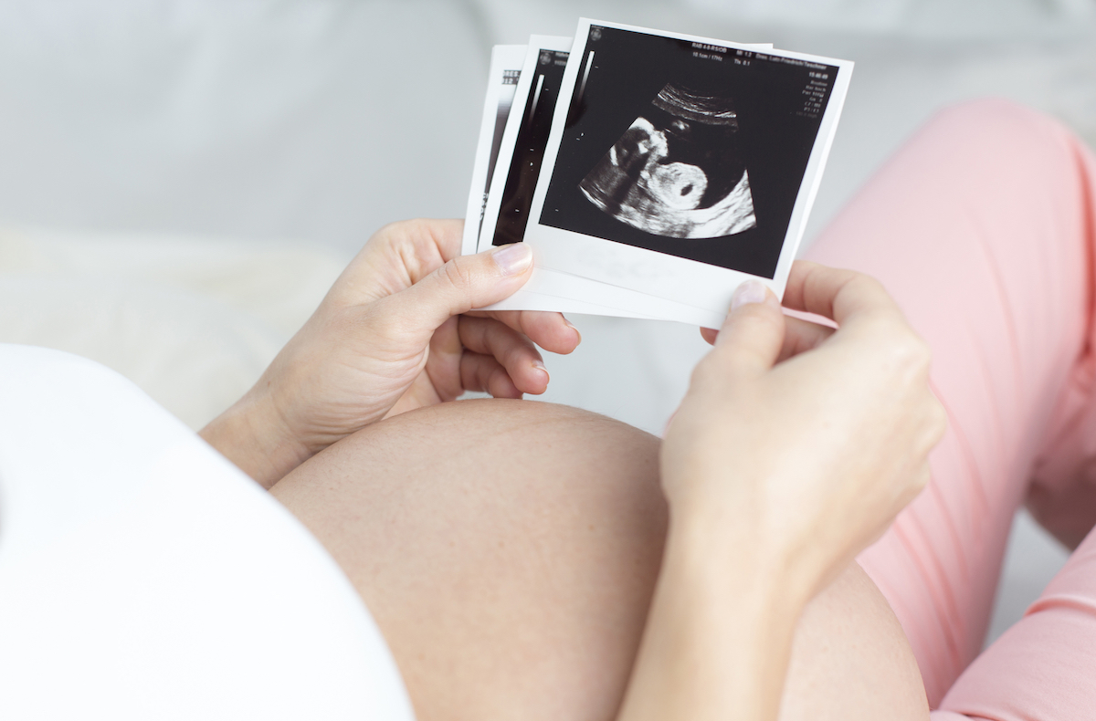 Embarazo reproducción asistida