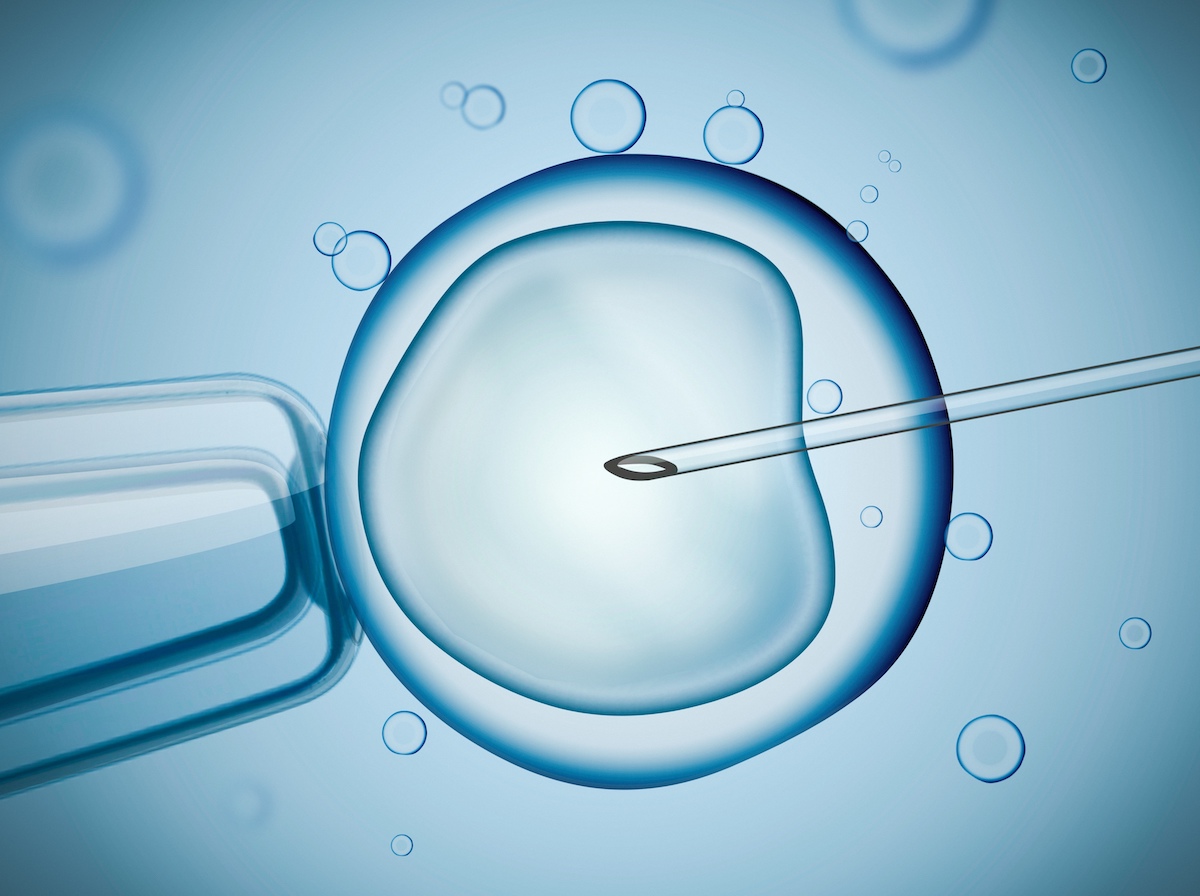 Tratamientos de fertilidad: ICSI