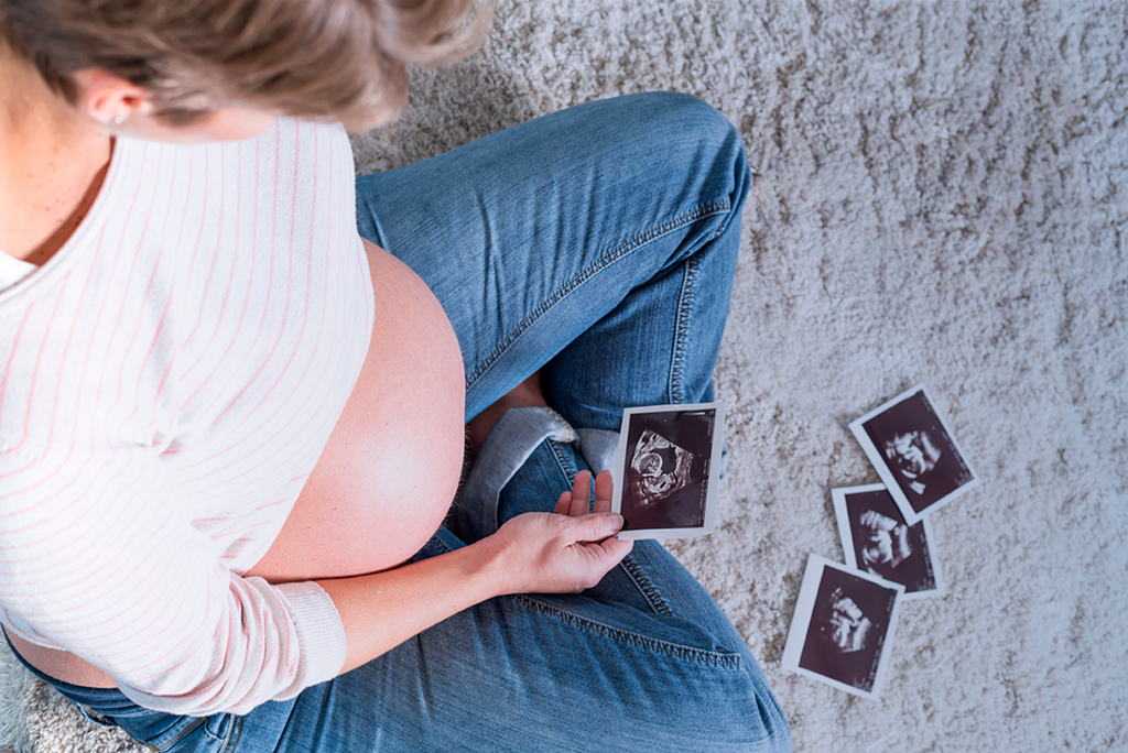 Las revisiones médicas durante el embarazo paso a paso
