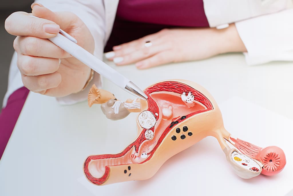 Cómo es el dolor en la endometriosis? | CREA Valencia